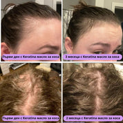 Keratina – Натурално Масло за Растеж на Коса