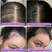 Keratina – Натурално Масло за Растеж на Коса