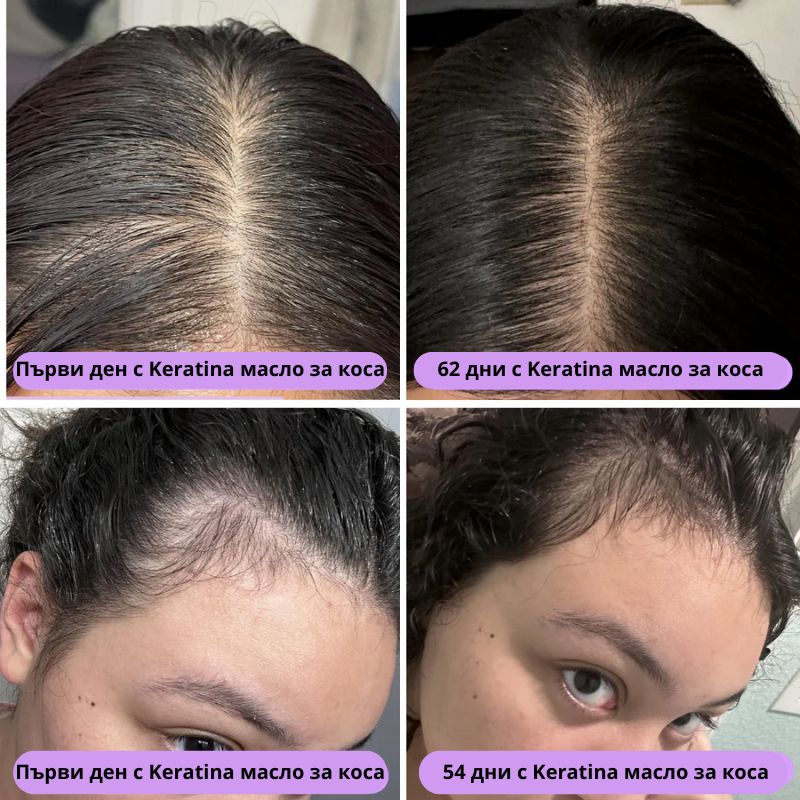 Keratina – Натурално Масло за Растеж на Коса